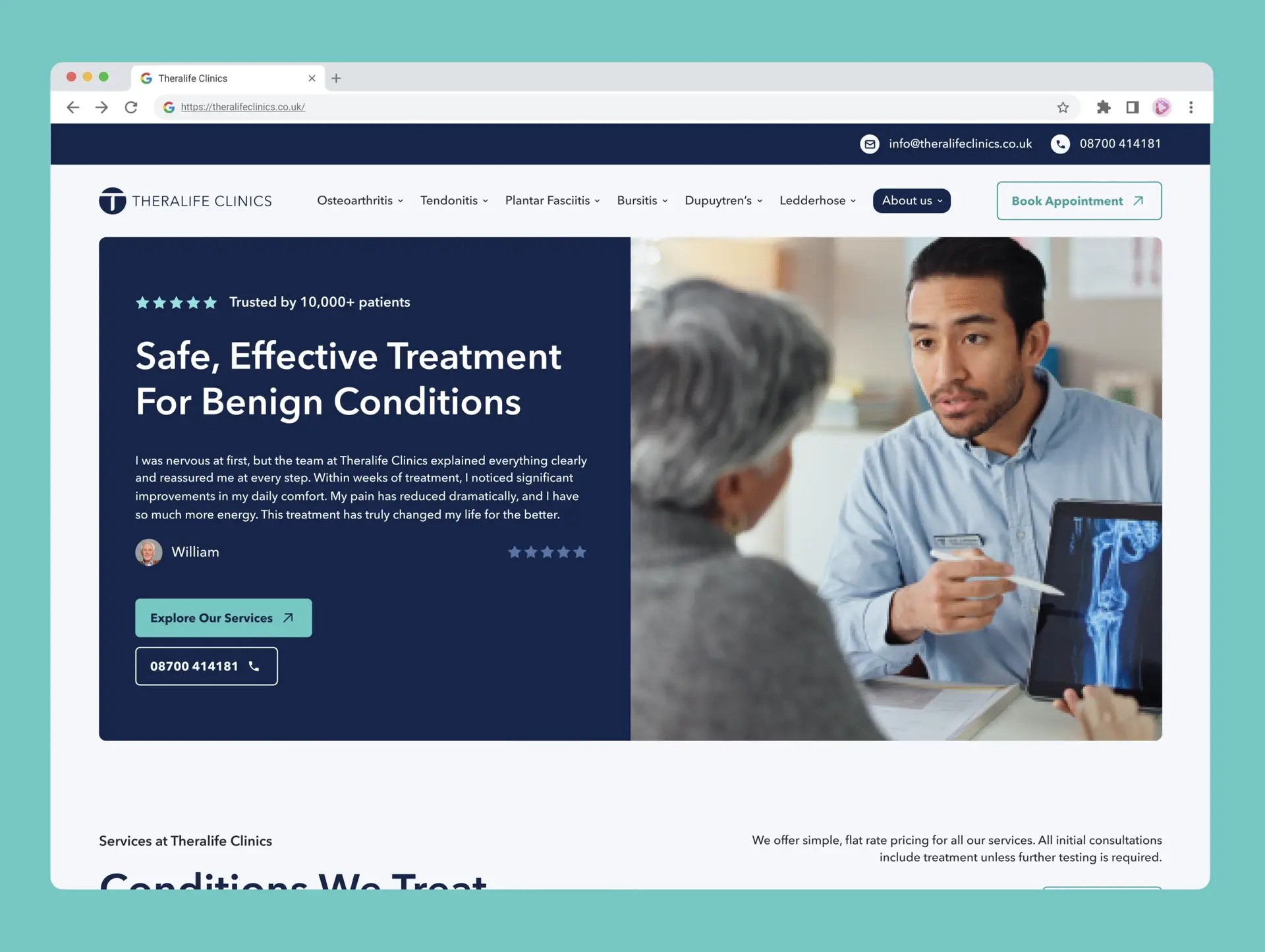 A doctor in a blue shirt sits at a desk, holding a tablet and speaking to an older woman with grey hair and glasses. The website shows “Safe, Effective Treatment For Benign Conditions” at Theralife Clinics, with buttons and reviews.