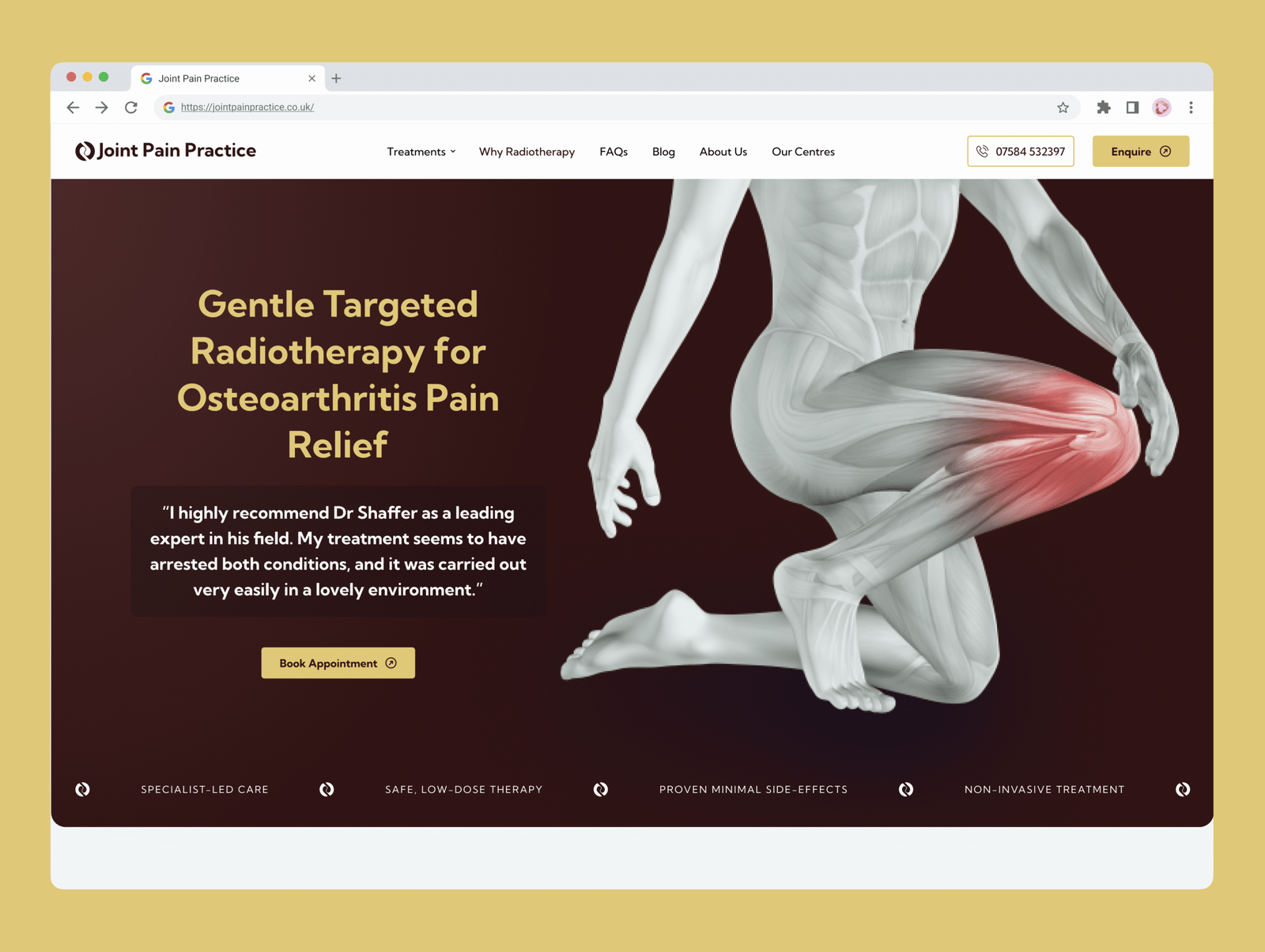 Screenshot of a medical website showing a greyscale illustration of a muscular figure holding their right knee, highlighted in red for pain. The text promotes radiotherapy for osteoarthritis pain relief at Gentle Procedures Clinic and features an appointment button.